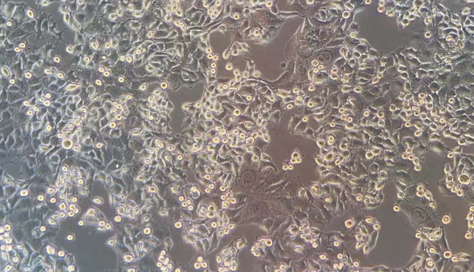  人肺鳞癌细胞HCC95(STR鉴定正确)