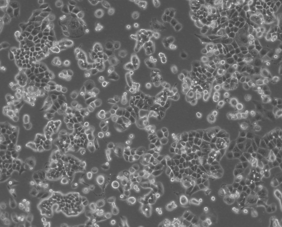 人子宫内膜癌细胞HEC-1-B(STR鉴定正确)