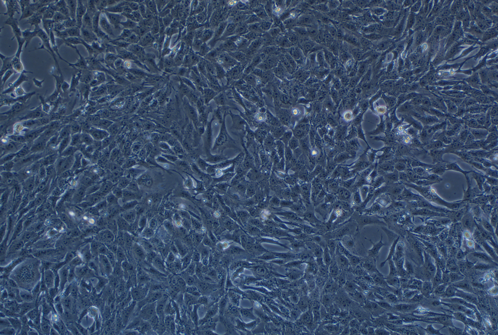 小鼠乳腺癌细胞4T1（ST鉴定正确）
