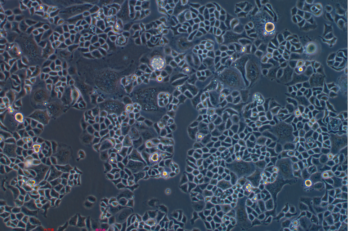 人宫颈癌细胞顺铂耐药株C33A+DDP(STR鉴定正确)