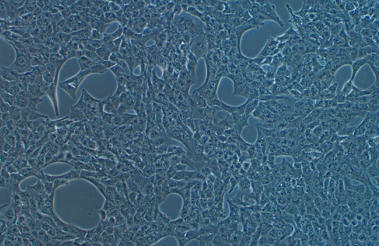 人肾癌细胞SN12C(STR鉴定正确)