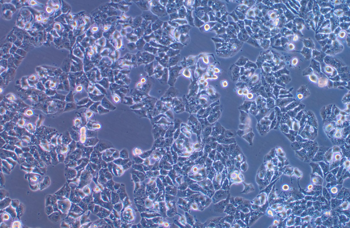 低转移人肝癌细胞MHCC97-L(STR鉴定正确)