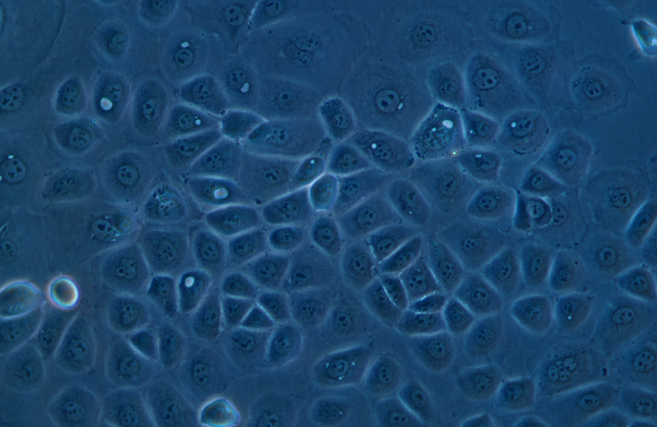 人卵巢癌腺癌细胞NIH:OVCAR-3(STR鉴定正确)