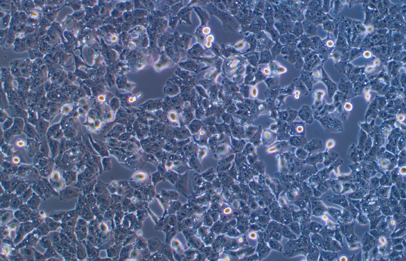 高转移人肝癌细胞带荧光素酶MHCC97-H+LUC（STR鉴定）