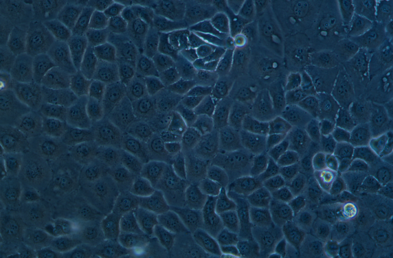 人卵巢癌腺癌细胞NIH:OVCAR-3(STR鉴定正确)