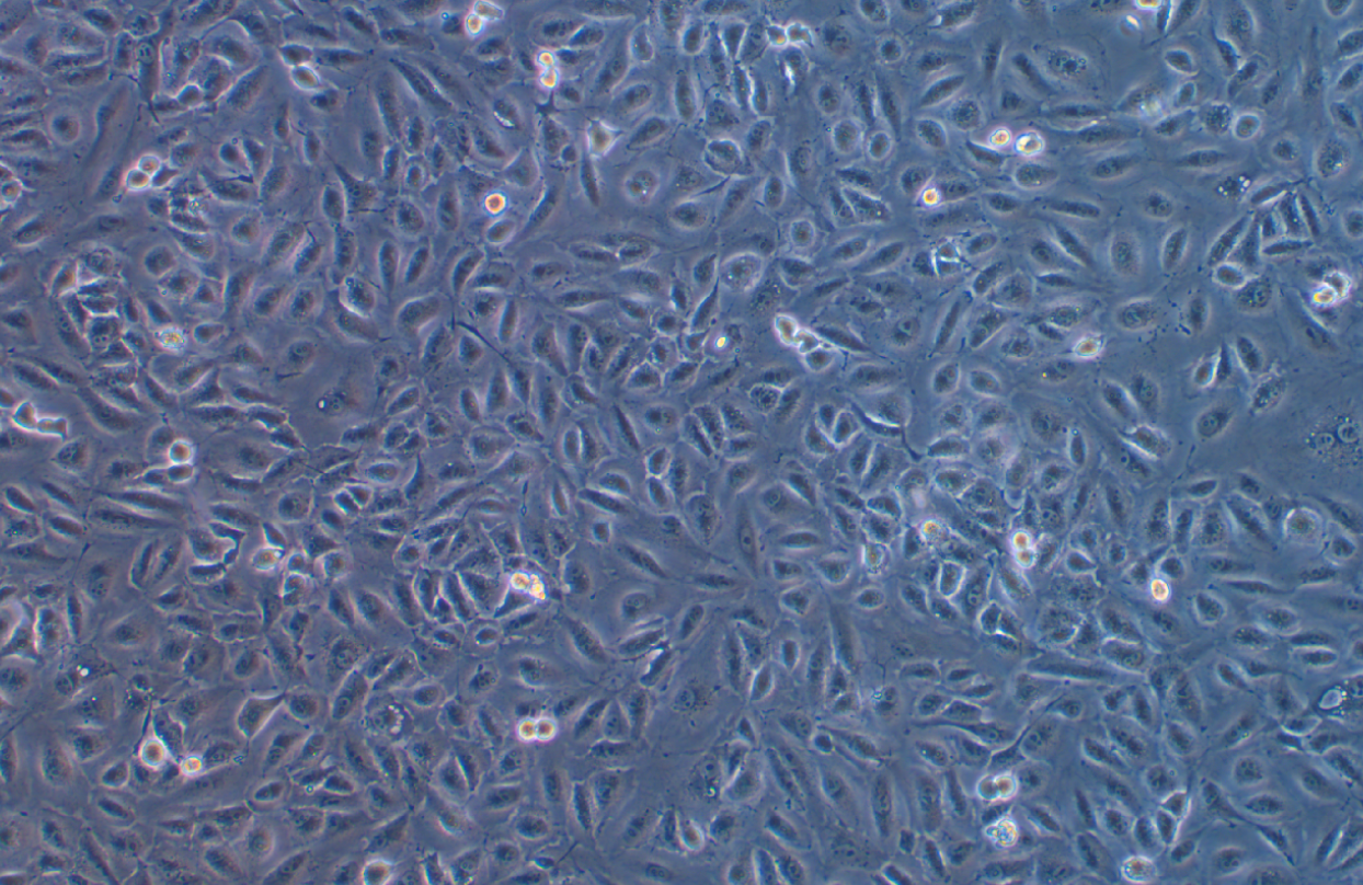人卵巢癌顺铂耐药株SKOV3/DDP(STR鉴定正确)