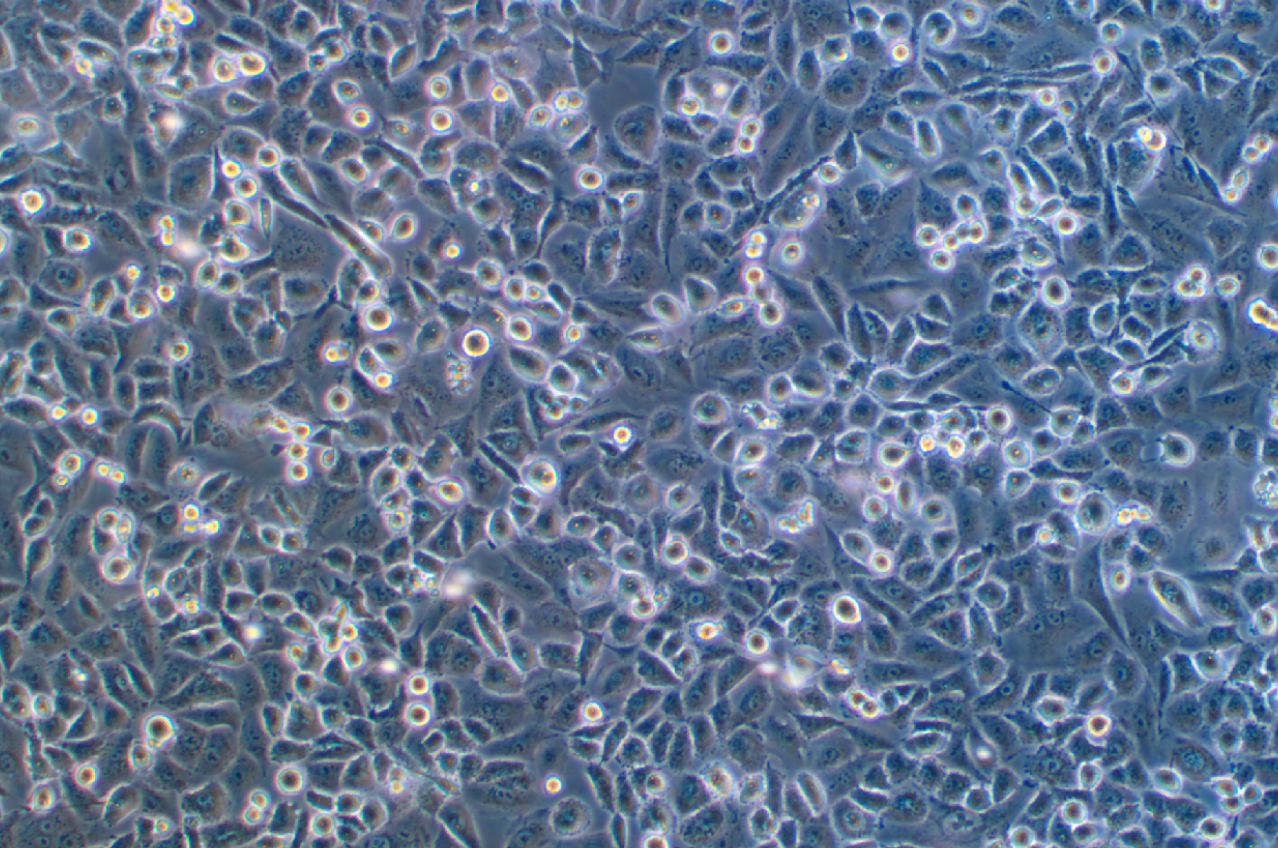   人胆管癌细胞CC-LP-1(STR鉴定正确)