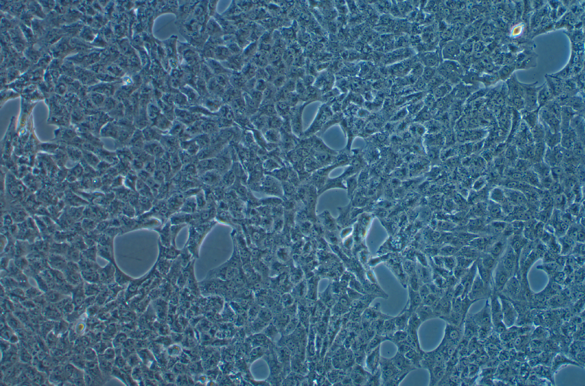 人肾癌细胞SN12C(STR鉴定正确)