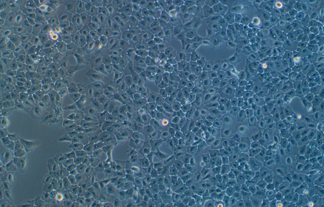 人涎腺腺样囊性癌细胞SACC-83(STR鉴定正确)