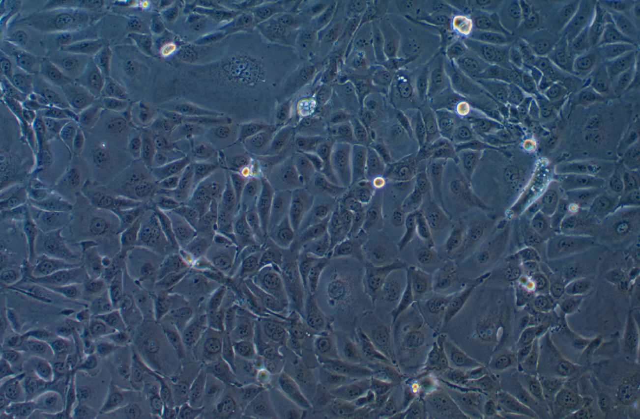 人肺腺癌细胞NCI-H3255(STR鉴定正确)