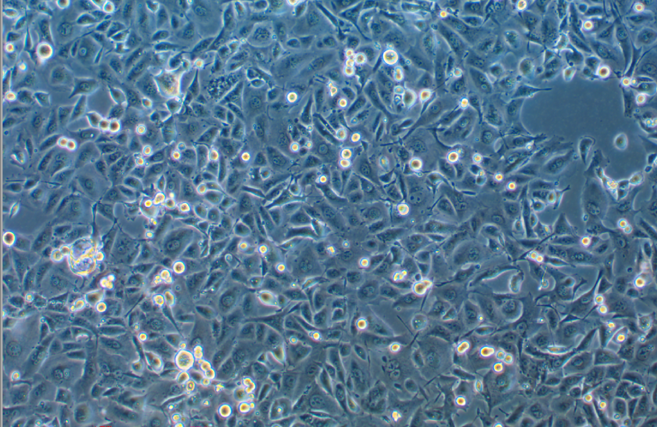 人非小细胞肺癌奥希替尼耐药株HCC-827+Osimertinib (STR鉴定正确)