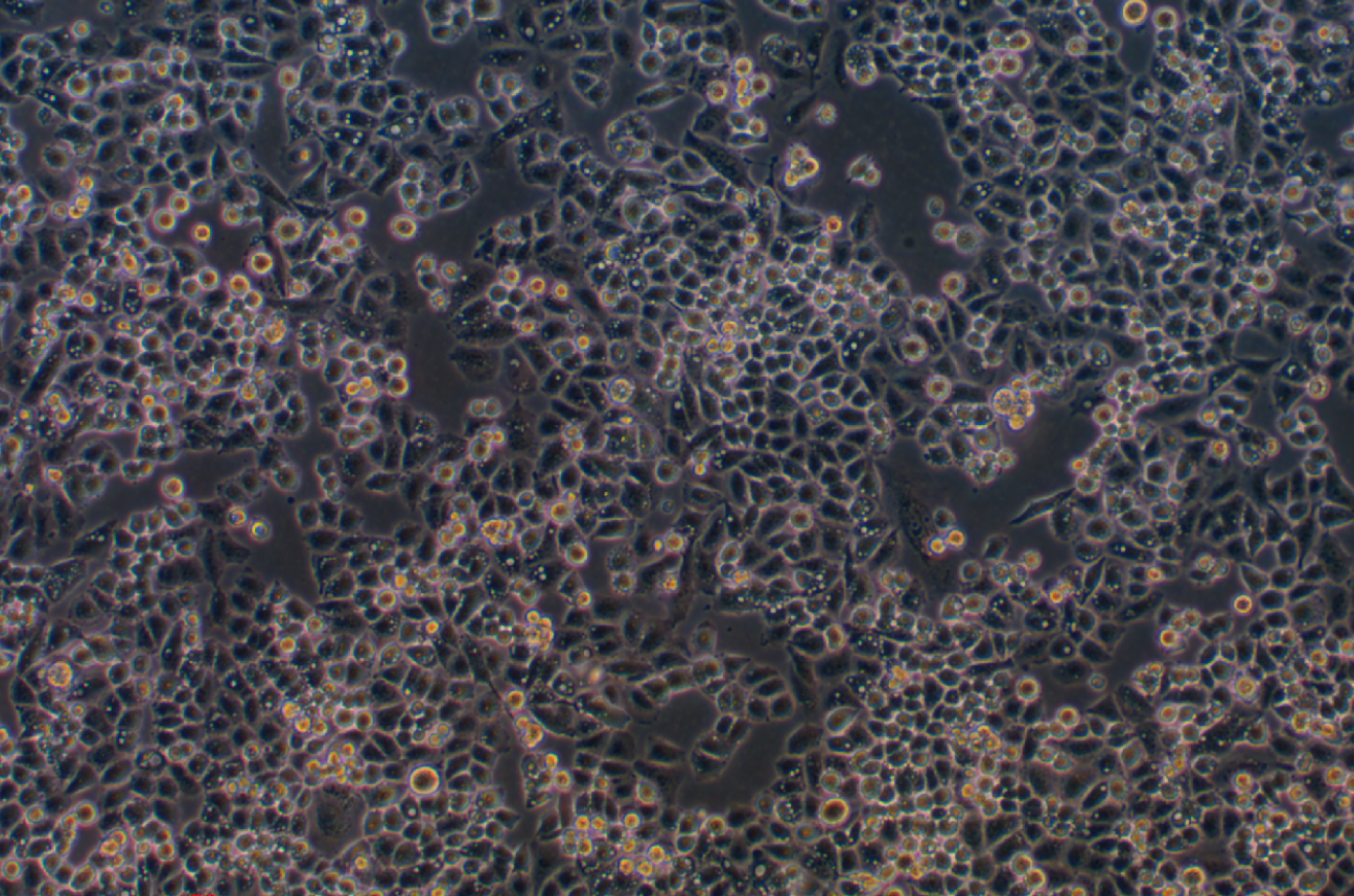 人宫颈癌细胞顺铂耐药株C33A+DDP(STR鉴定正确)