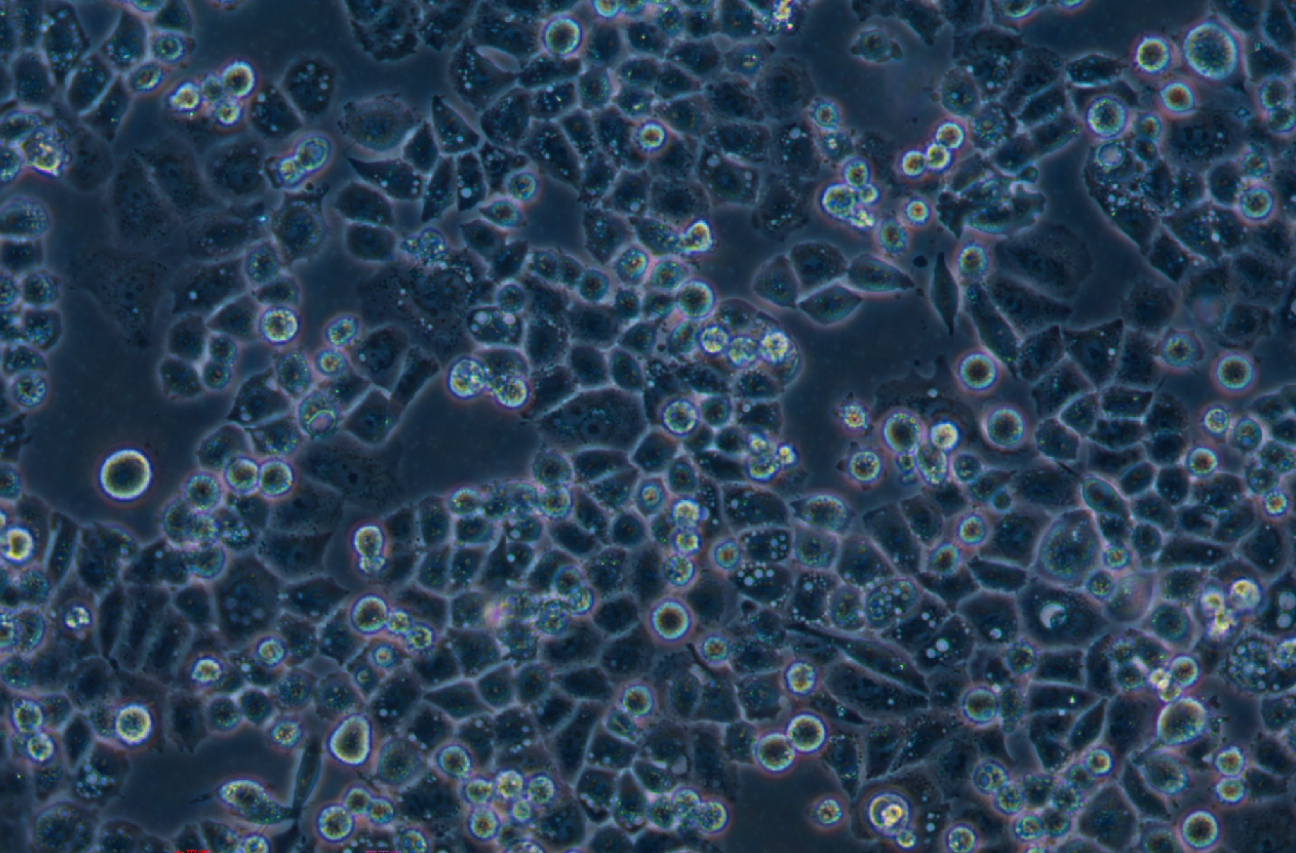 人宫颈癌细胞顺铂耐药株C33A+DDP(STR鉴定正确)