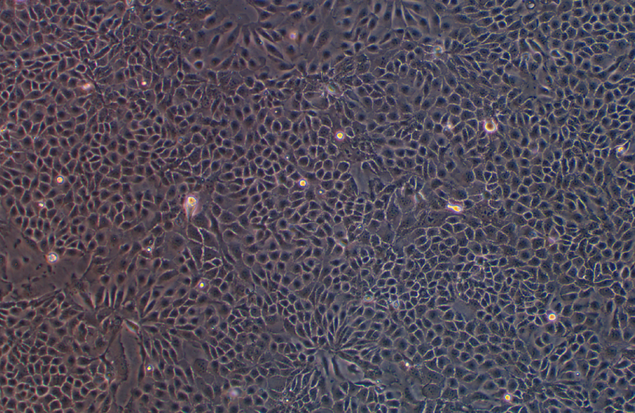 人结肠癌奥沙利铂耐药株HCT-8+Oxaliplatin(STR鉴定正确)