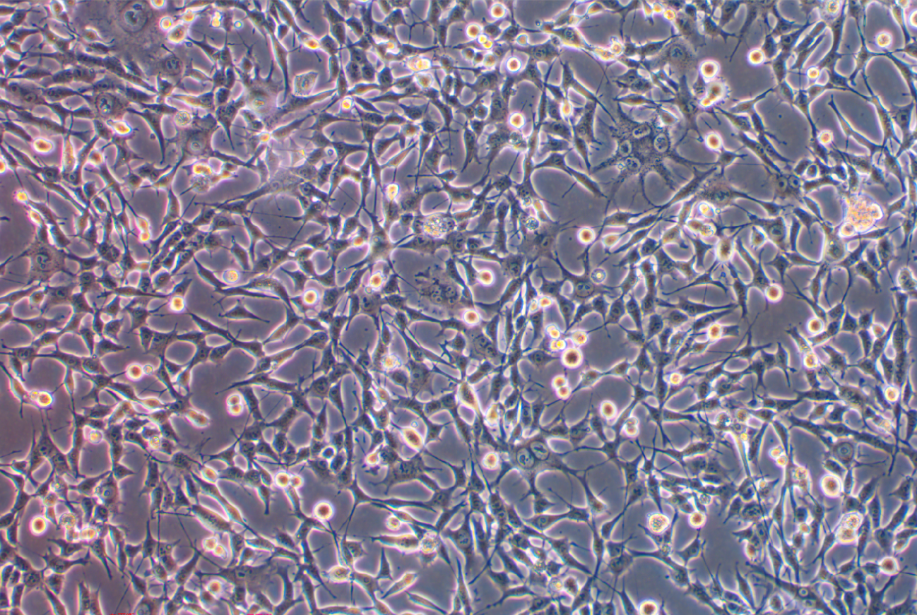  人乳腺导管癌细胞MDA-MB-435S(STR鉴定正确)