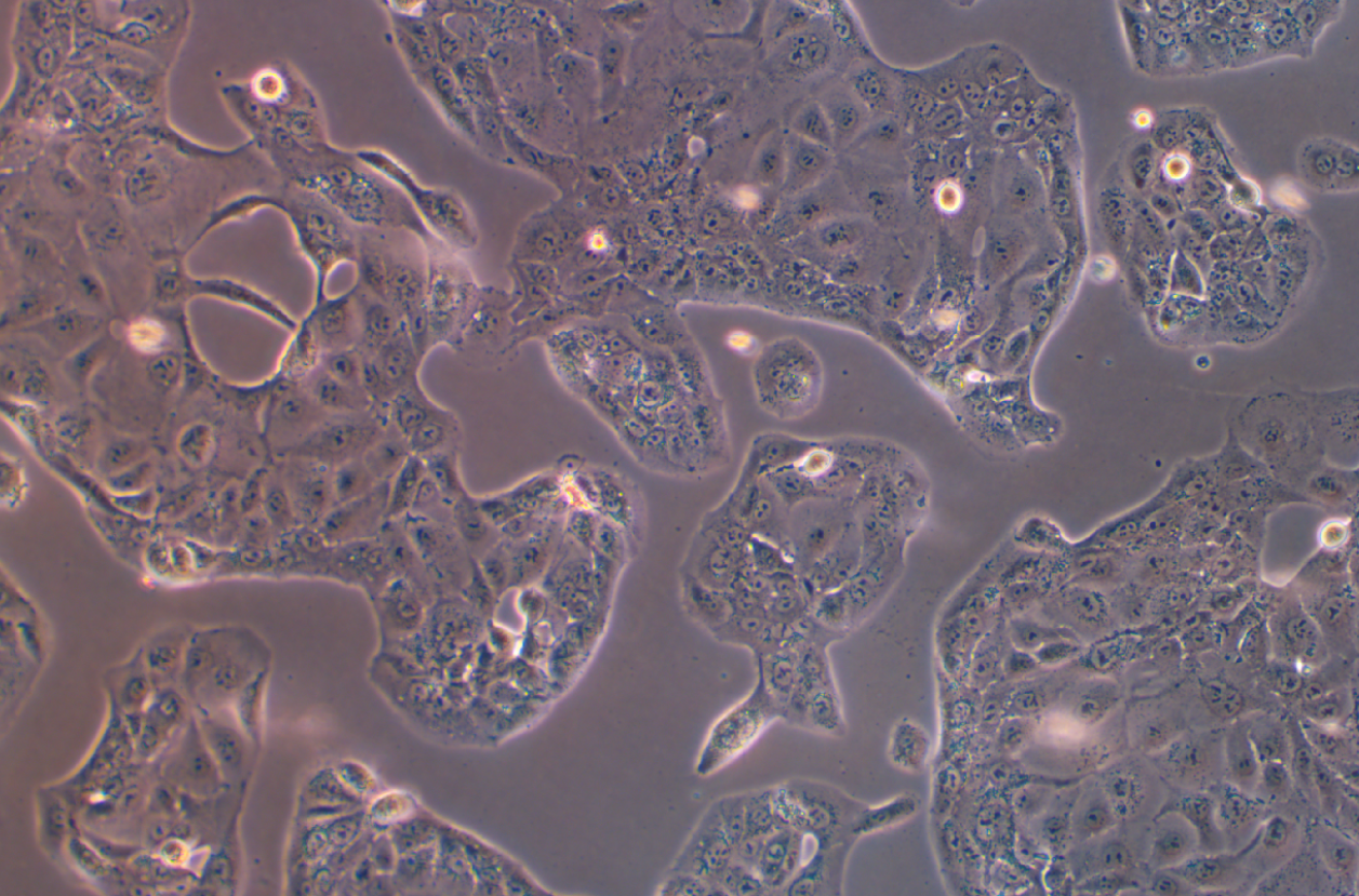 人肺乳头状腺癌细胞NCI-H820(STR鉴定正确)