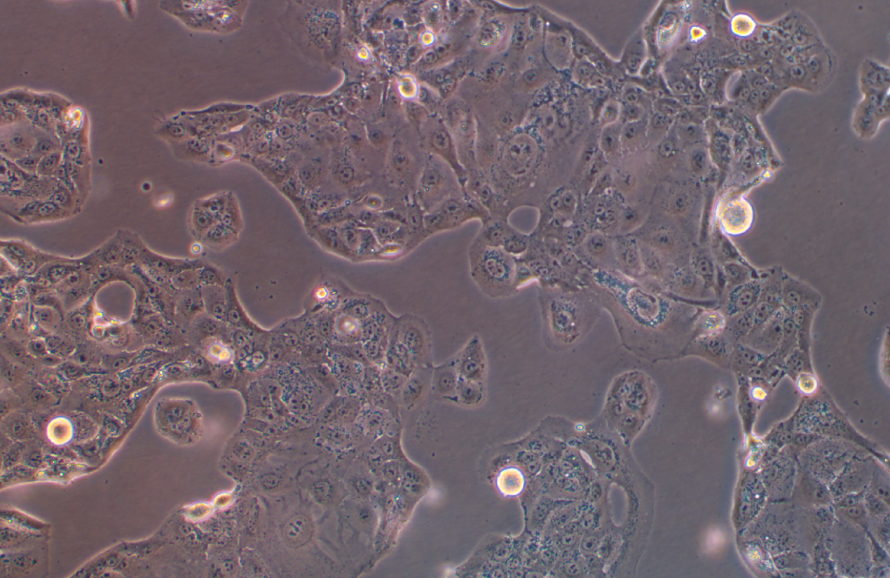 人肺乳头状腺癌细胞NCI-H820(STR鉴定正确)