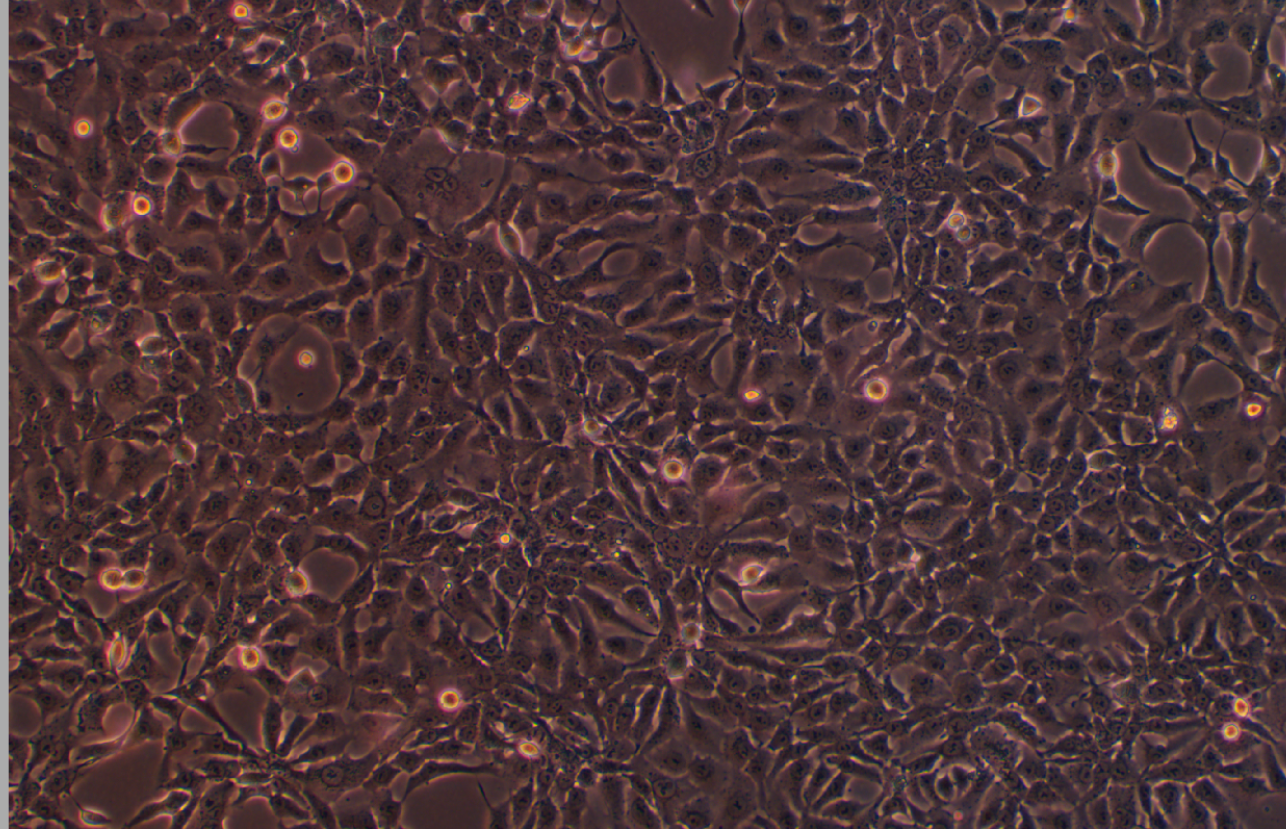 人肺腺癌细胞 NCI-H2009(STR鉴定正确)