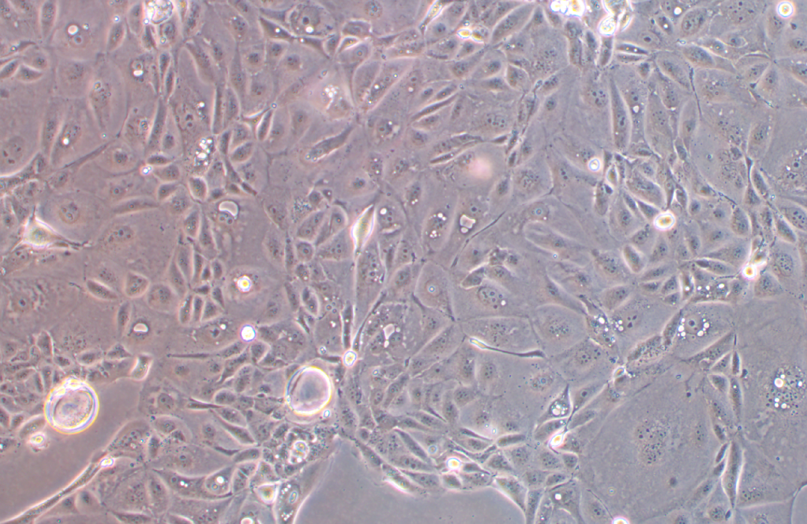人胰腺癌吉西他滨耐药株SW1990/G(STR鉴定正确)