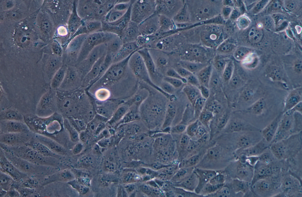 人胰腺癌吉西他滨耐药株SW1990/G(STR鉴定正确)