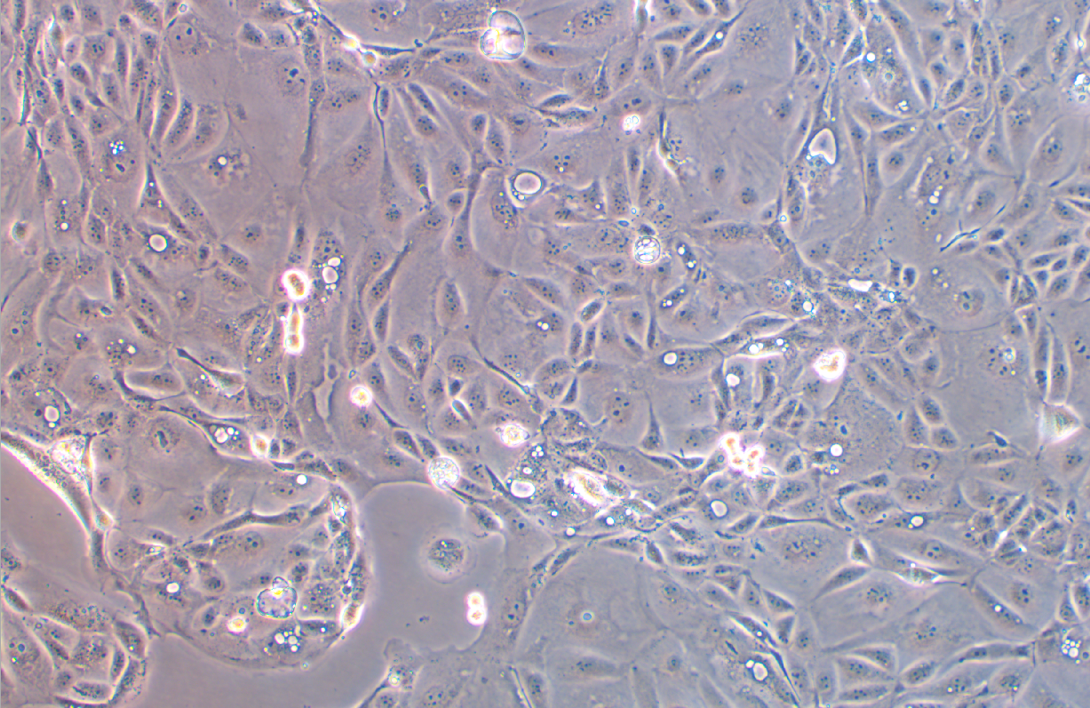 人胰腺癌吉西他滨耐药株SW1990/G(STR鉴定正确)