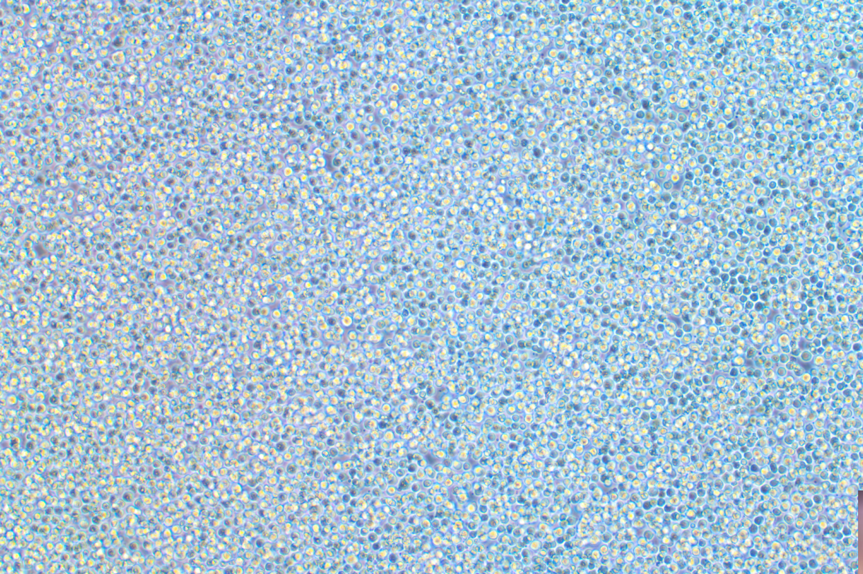 人弥漫大B淋巴瘤细胞WSU-DLCL-2(STR鉴定正确)