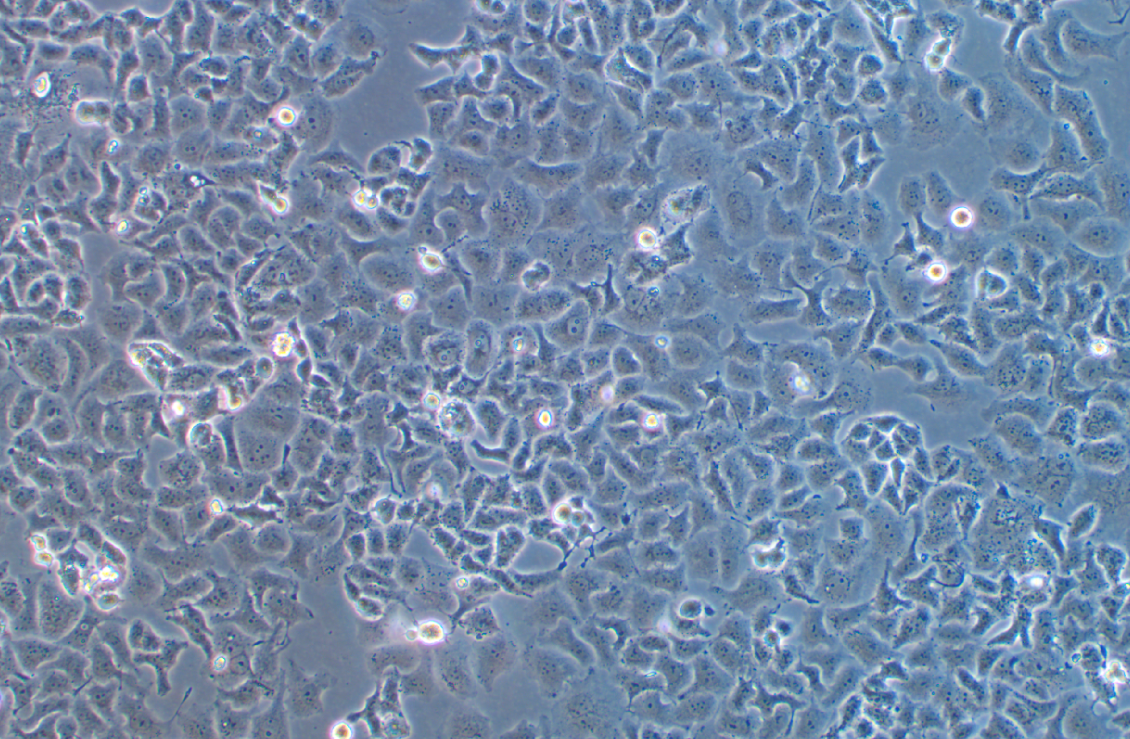 人非小细胞肺癌腺癌细胞NCI-H522 (STR鉴定正确)
