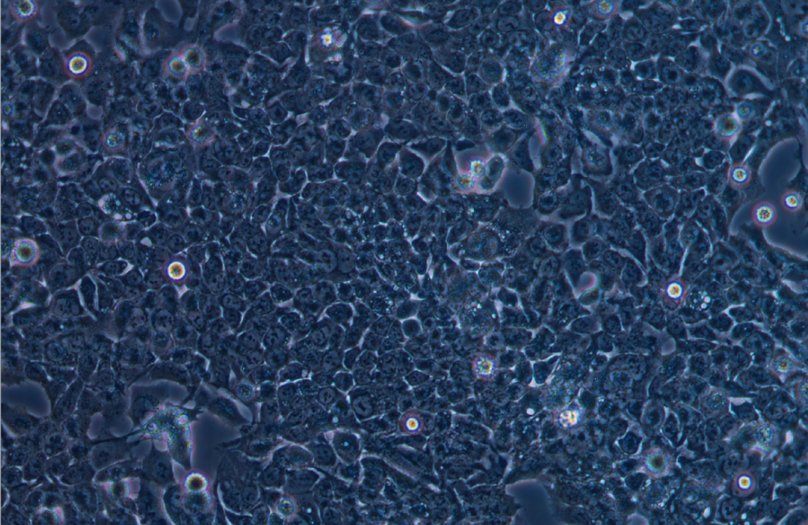 人结肠癌耐奥沙利铂耐药株HCT-116+Oxaliplatin(STR鉴定正确)