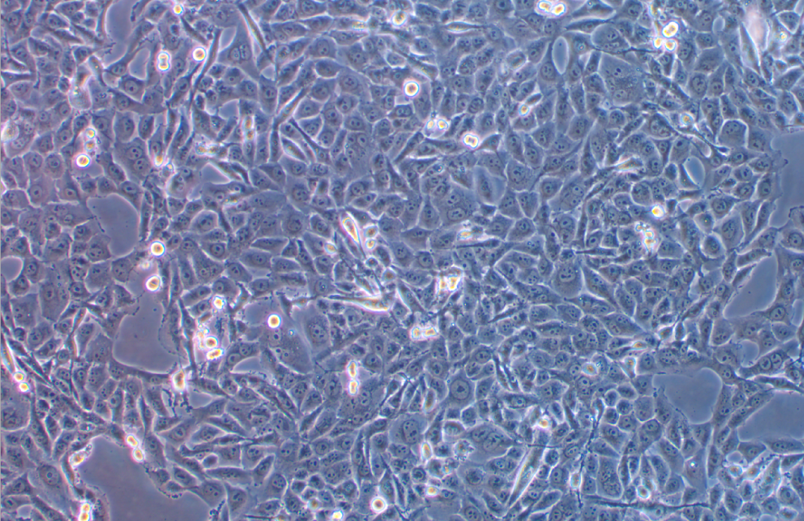 人肺癌腺癌细胞NCI-H1573 (STR鉴定正确)