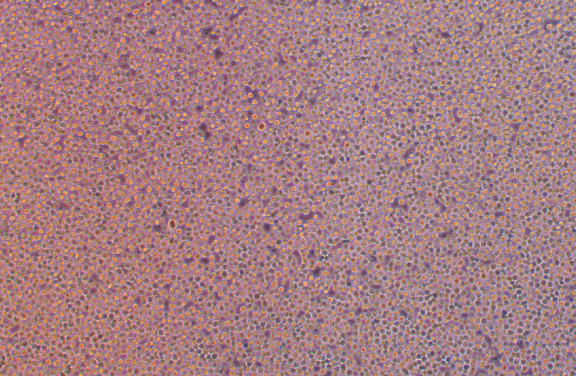 人急性髓性白血病细胞OCI-AML-2(STR鉴定正确)