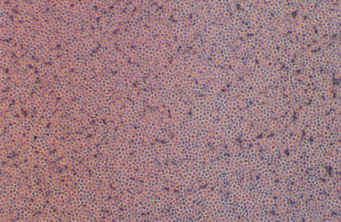 人急性髓性白血病细胞OCI-AML-2(STR鉴定正确)