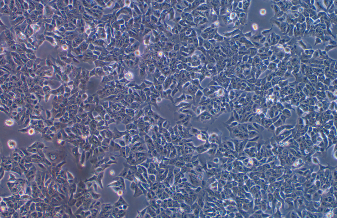人结直肠腺癌细胞长春新碱耐药株HCT-8/V(STR鉴定正确)