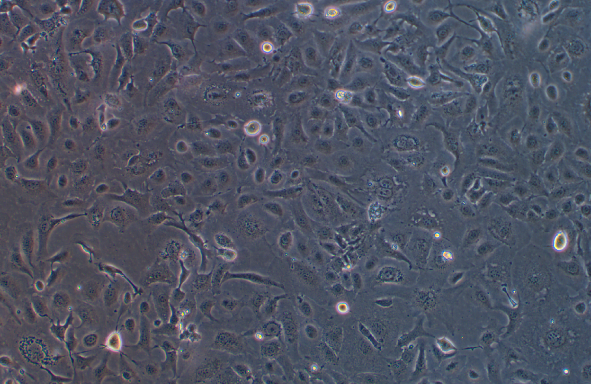 人卵巢癌细胞尼拉帕利SK-OV-3+Niraparib  (STR鉴定正确)