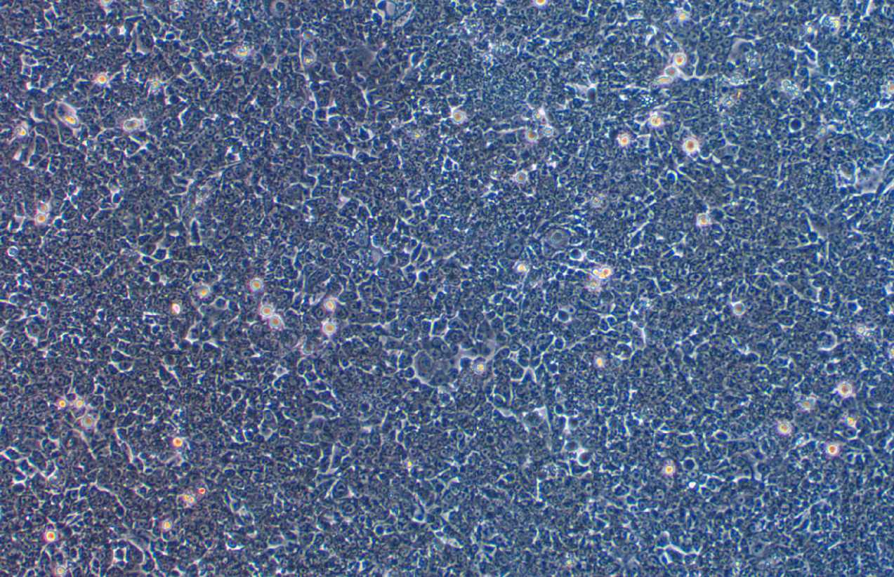 人结肠癌耐5氟尿嘧啶耐药株HCT-116+5-Fluorouracil(STR鉴定正确)