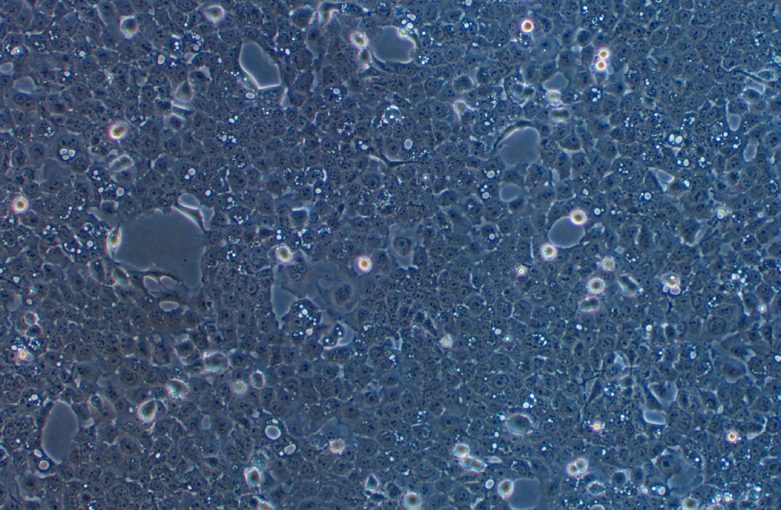  人口底鳞癌细胞UM-SCC-1(STR鉴定正确)