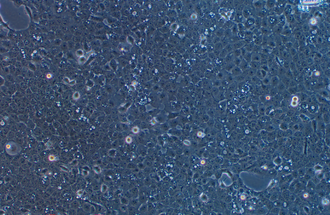  人口底鳞癌细胞UM-SCC-1(STR鉴定正确)