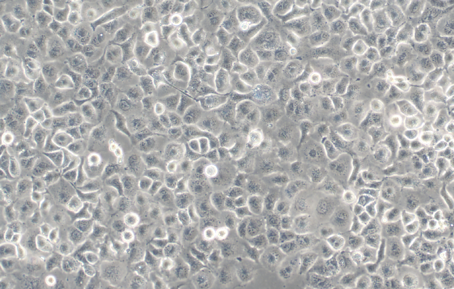 人大细胞肺癌细胞NCI-H661(STR鉴定正确)