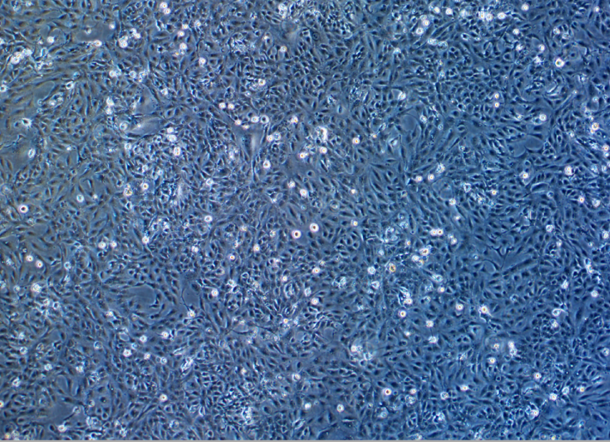 类滤泡状甲状腺癌细胞肺转移FTC-238(STR鉴定正确)