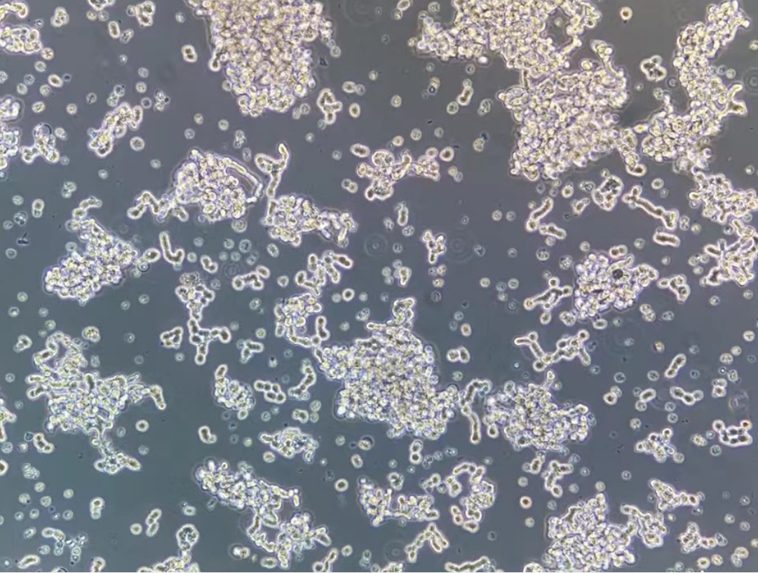 人视网膜母细胞瘤WERI-Rb-1(STR鉴定正确)
