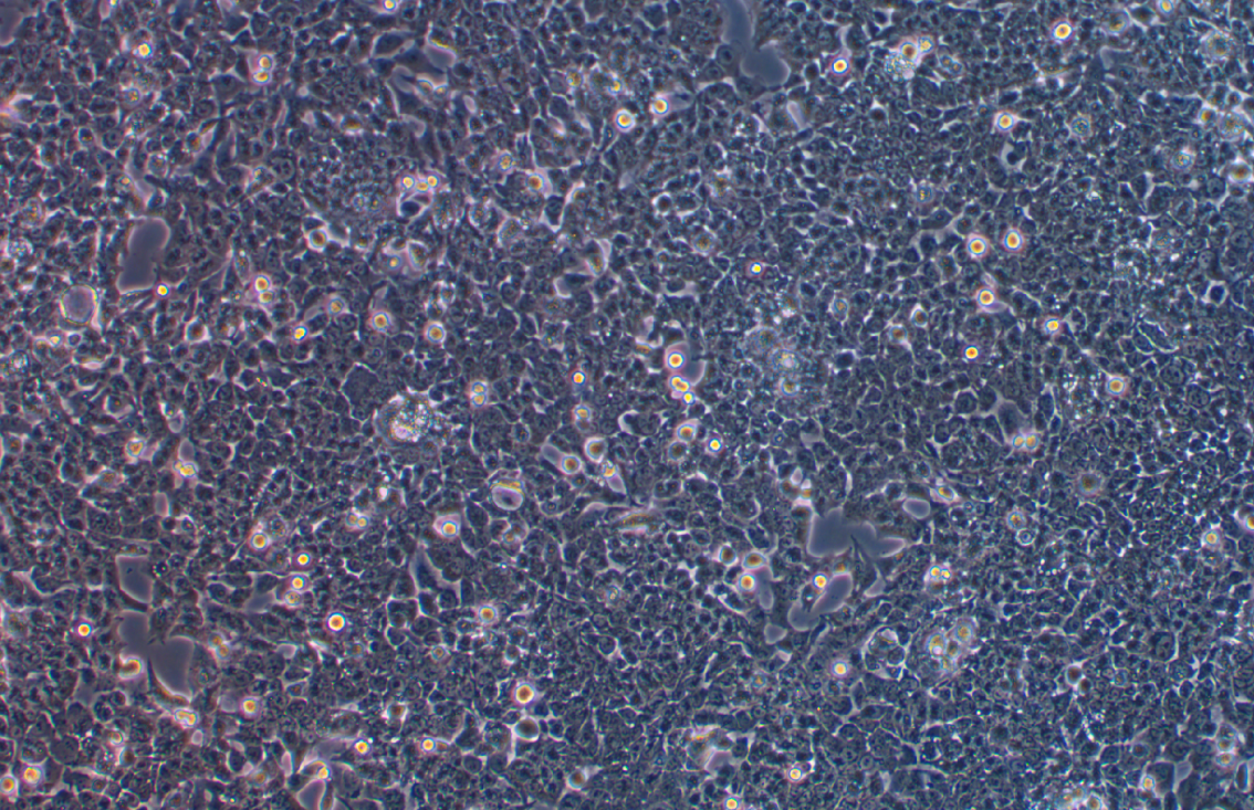 人结肠癌细胞带绿色荧光HCT-116+GFP(STR鉴定正确)