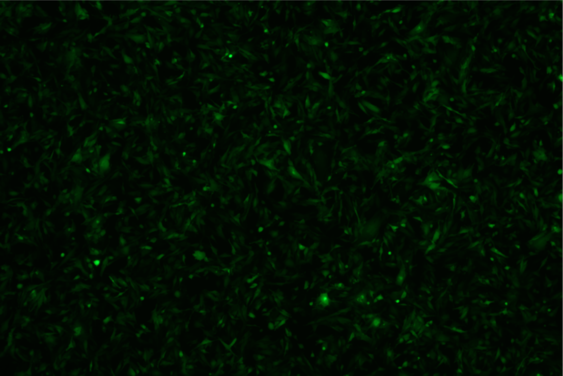 人神经胶质细胞瘤细胞带绿色荧光U251+GFP(STR鉴定正确)