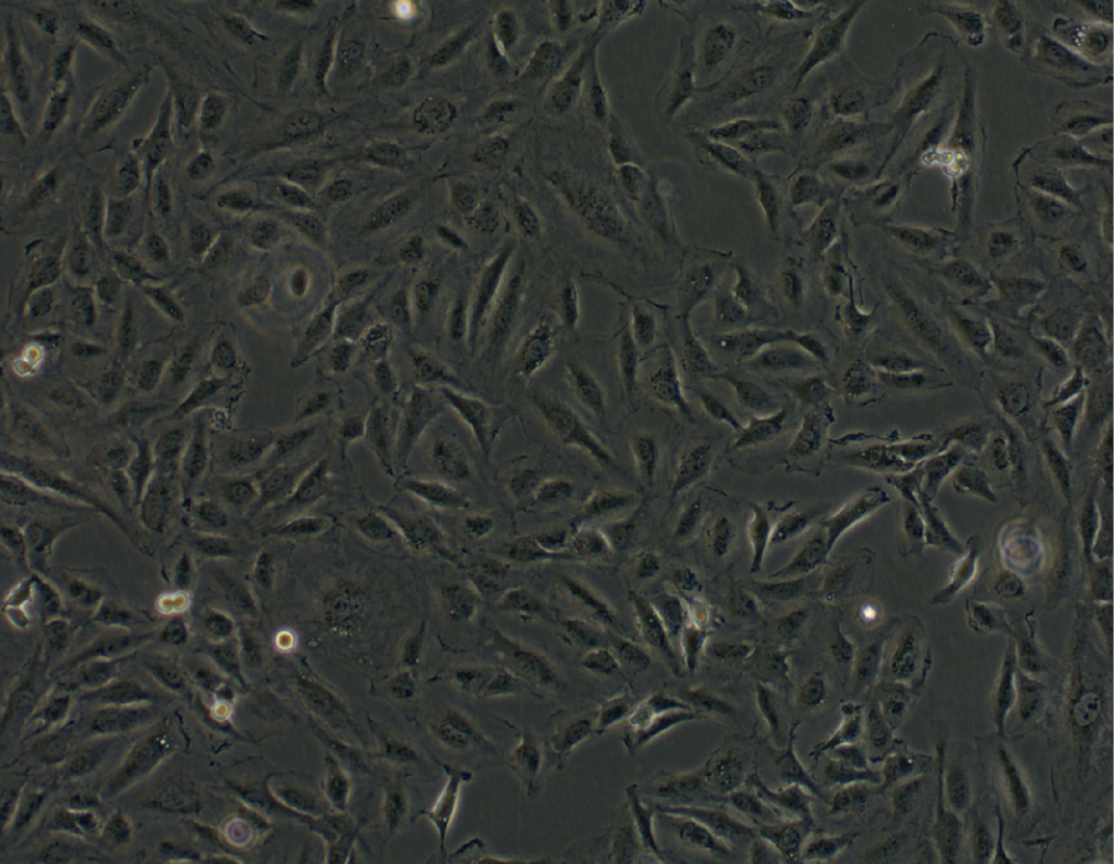人甲状腺癌细胞KTC-1(STR鉴定正确)