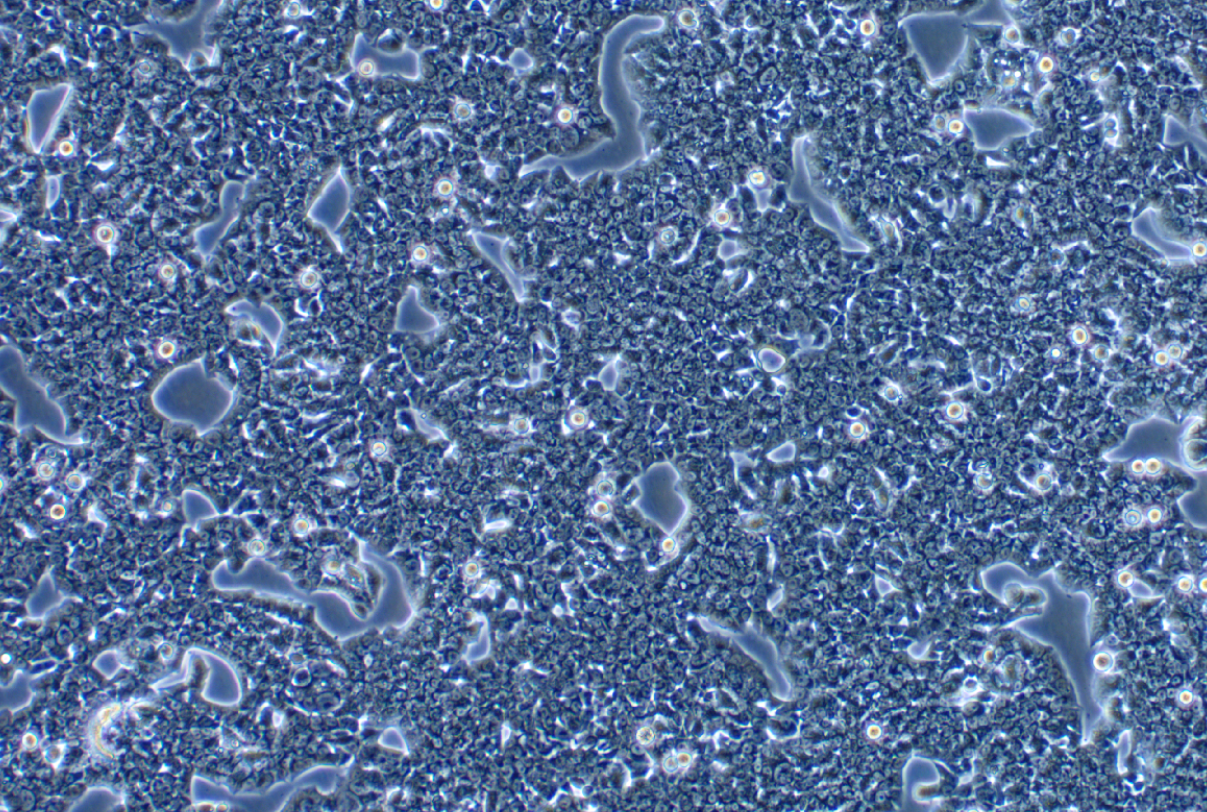  人肺癌腺癌细胞HCC1833 (STR鉴定正确)