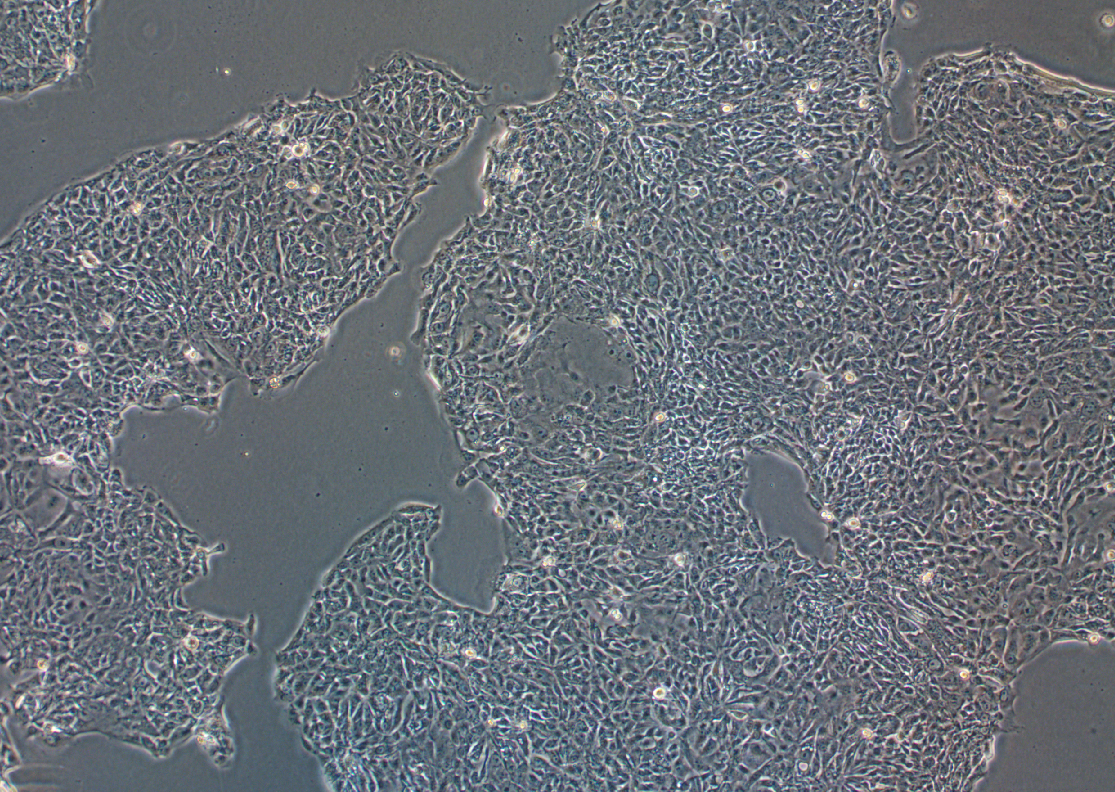 人肺癌腺癌细胞NCI-H1648 (STR鉴定正确)