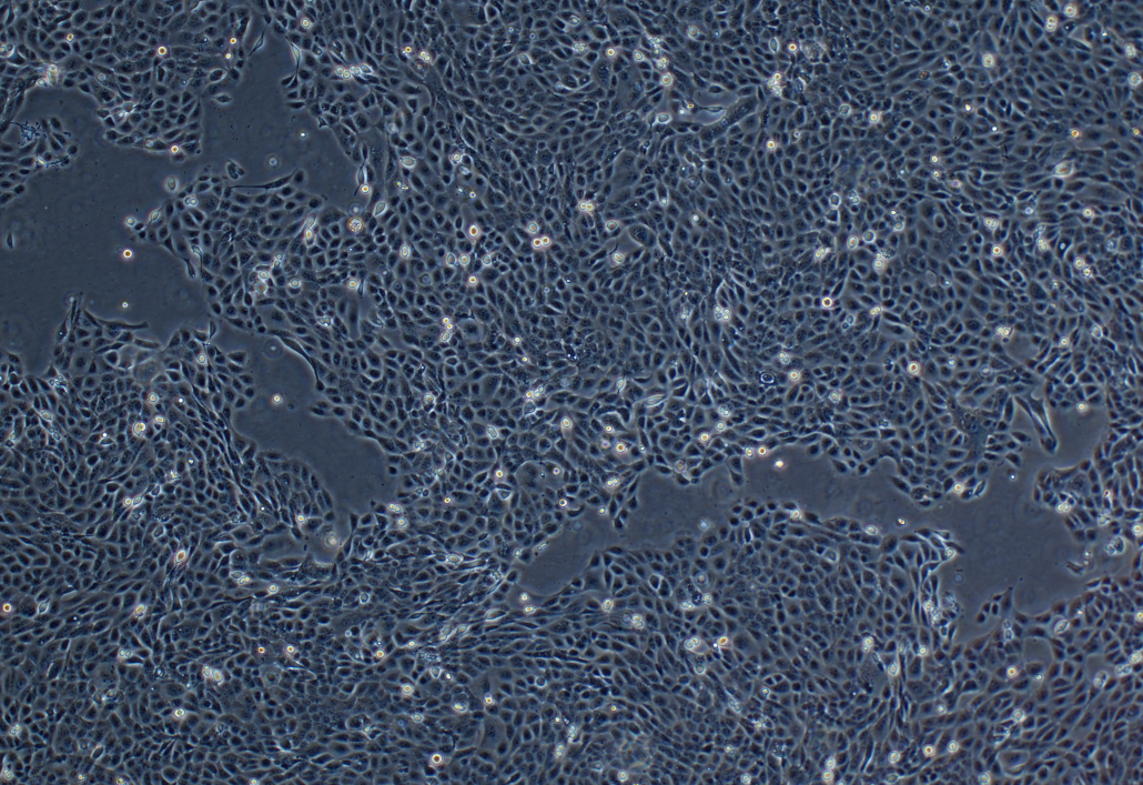 人口腔鳞癌细胞PE/CA-PJ41(STR鉴定正确)